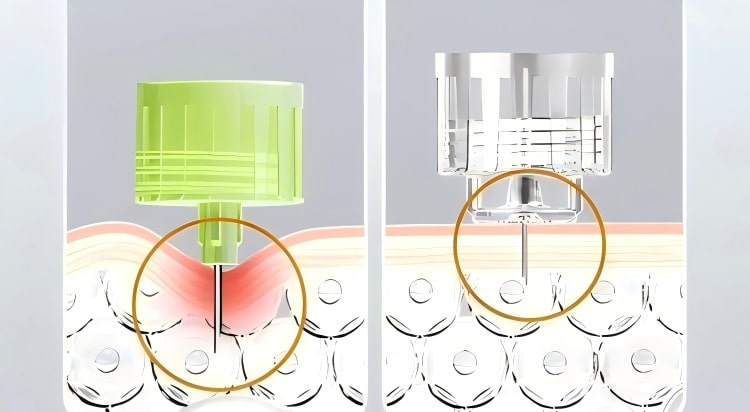 insulin-pen-needle-single-use-medical-device