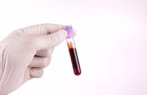 vacuum-blood-collection-tubes-different-colors-medical-laboratory-equipment-healthcare-supplies