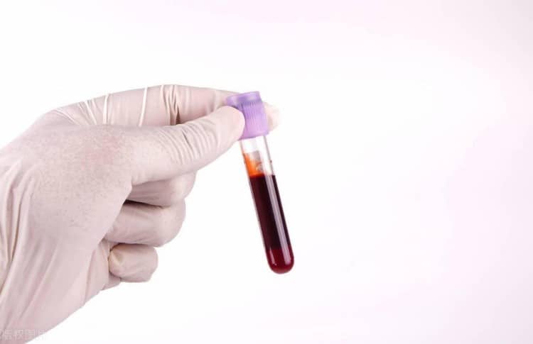 Complete Guide to Vacuum Blood Collection Tubes: Types, Technology, Market & Strategy for US Healthcare
