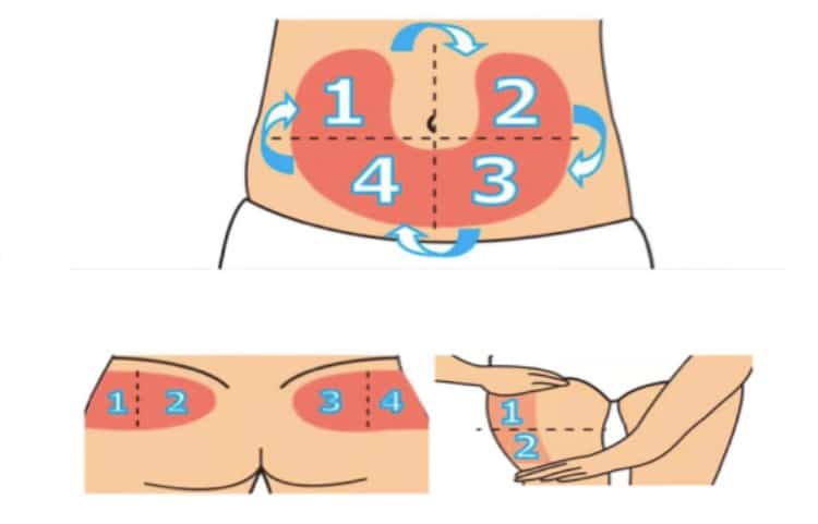 four-major-injection-site-rotation-areas-abdomen-thigh-arm-buttocks-diabetes-care
