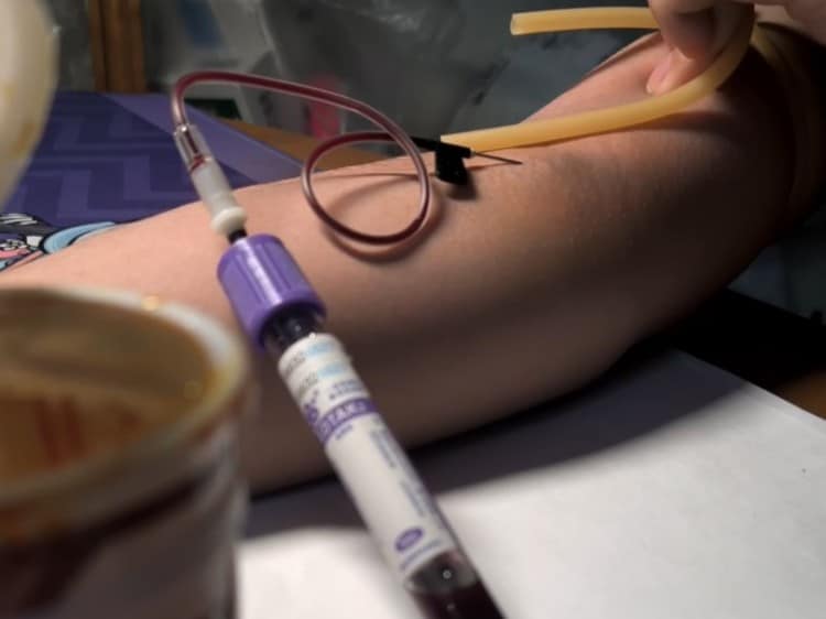 Vacuum Blood Collection Tube Selection Guide: Strategic Sourcing for Healthcare Professionals