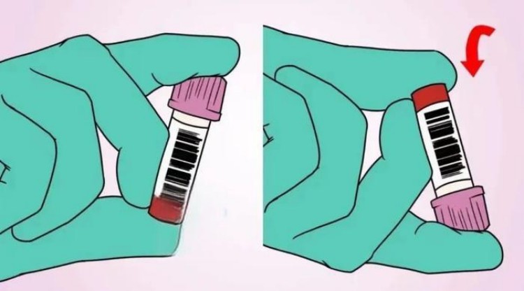 blood-specimen-mixing-technique-demonstration