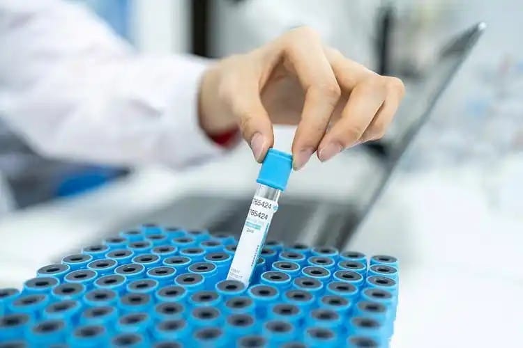 blue-tube-coagulation-testing