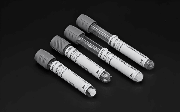 gray-tube-glucose-testing