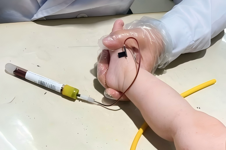 pediatric-blood-collection-specialized-techniques