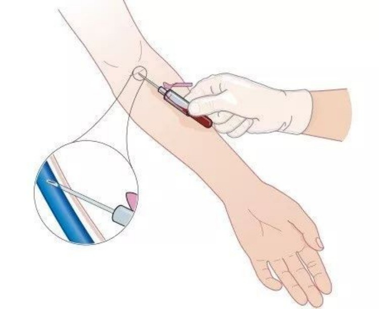 professional-venipuncture-technique-demonstration