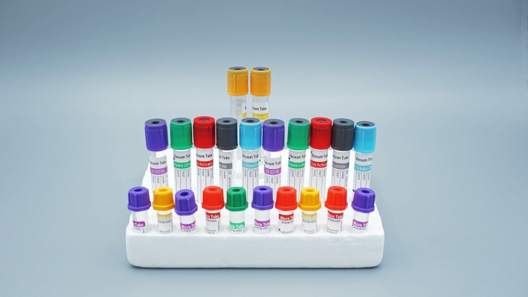vacuum-blood-collection-tubes-overview