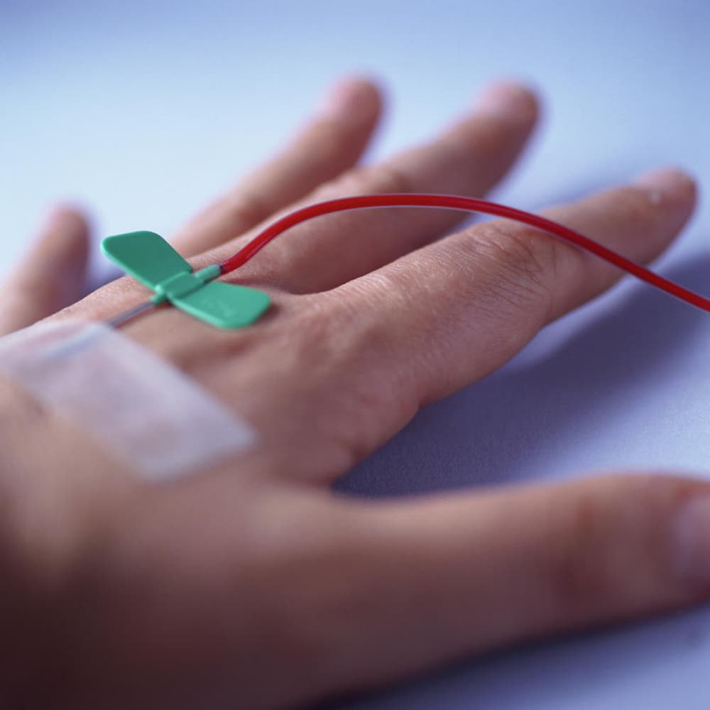 butterfly needle in use demonstration