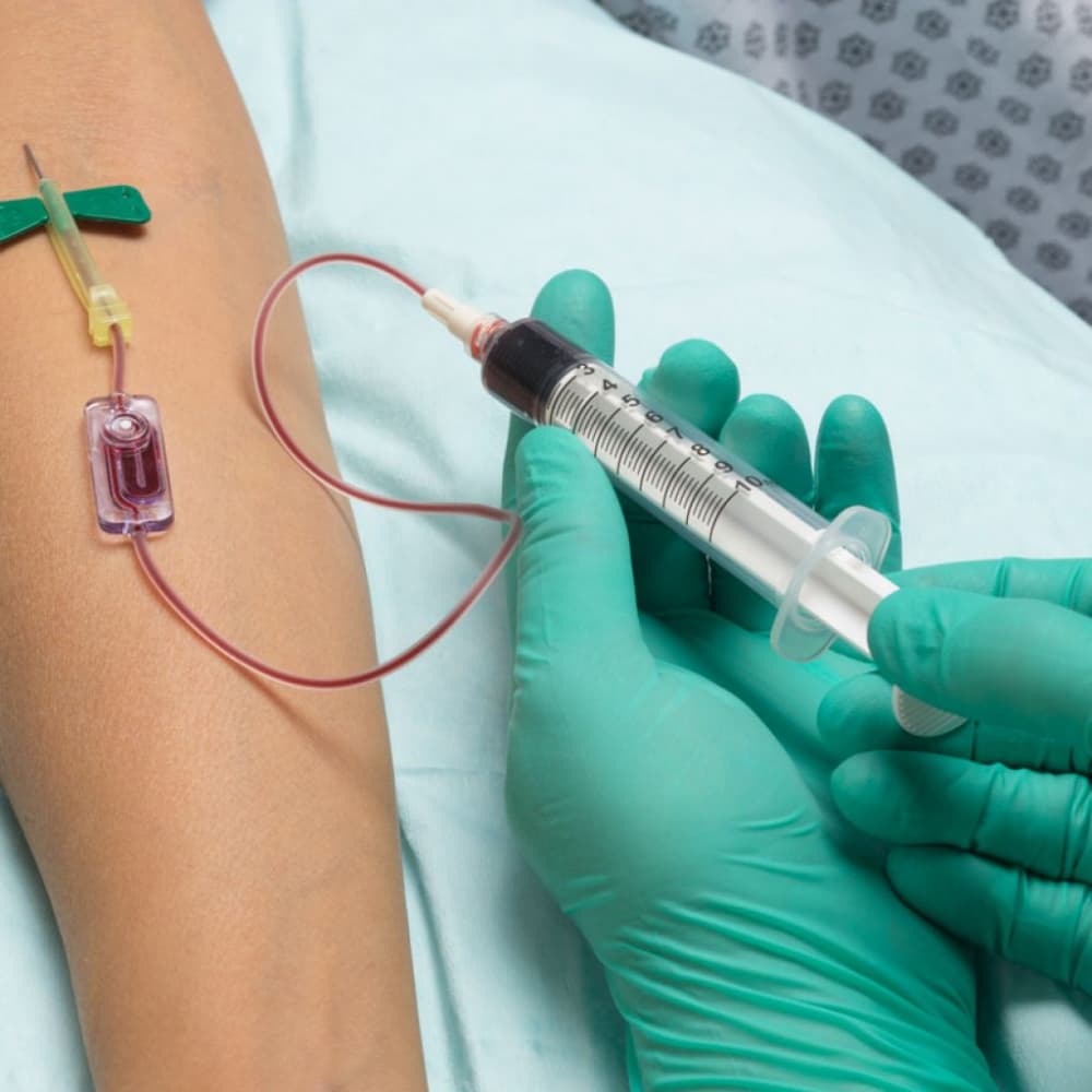 butterfly needle iv therapy patient arm
