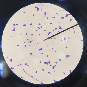 disposable-syringe-sterility-standards