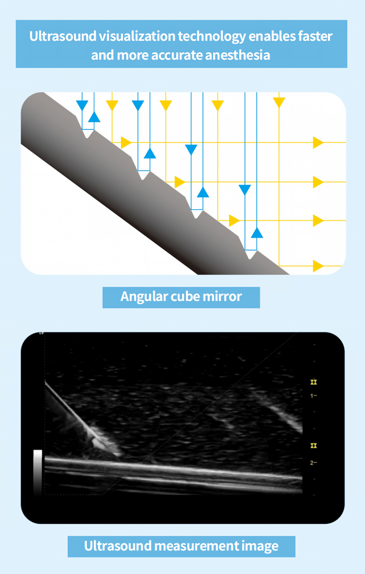 Customize Medical Nerve Block Needle From Kohope