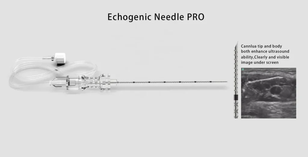 Essential Nerve Block Needle with Echogenic Technology for Precision