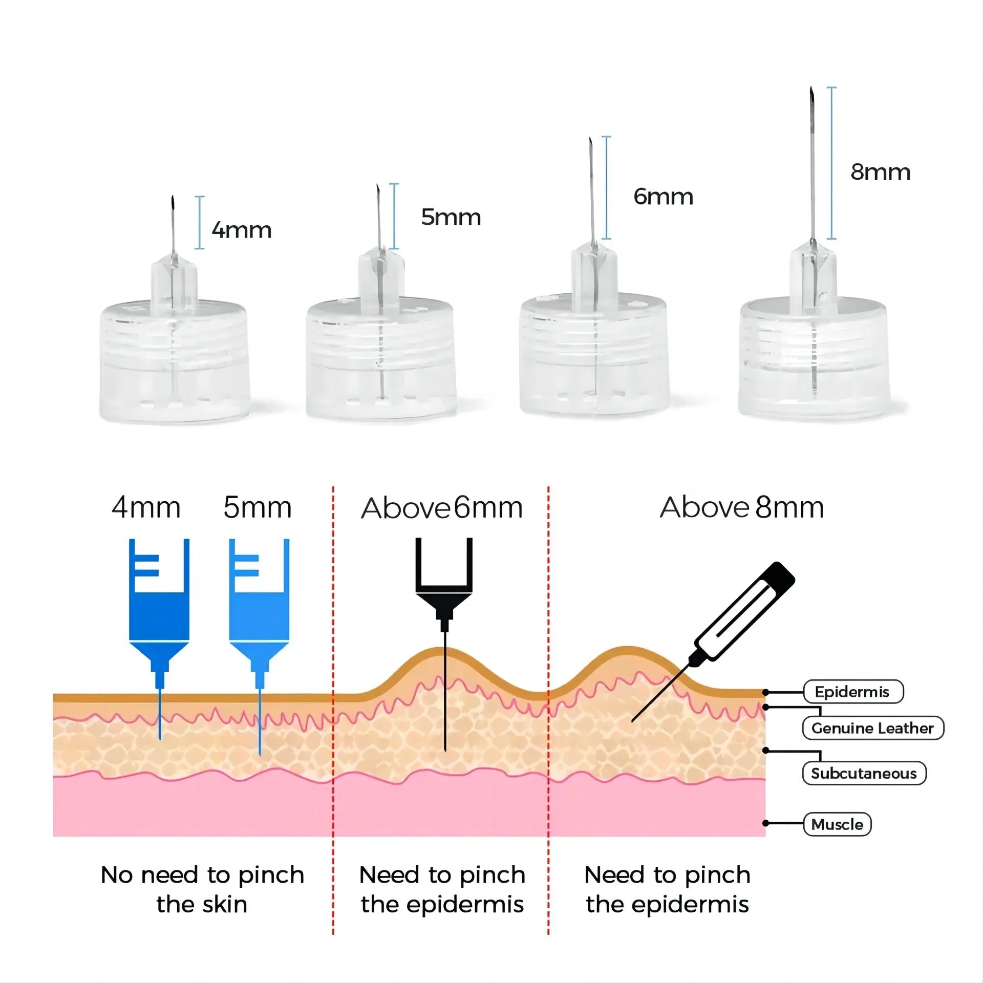 Illustration of subcutaneous injection technique using ultra-fine Kohope insulin pen needles into skin layer